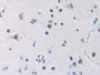 DAB staining on IHC-P; Samples: Human Cerebrum Tissue; Primary Ab: 10µg/ml Rabbit Anti-Human TFR Antibody Second Ab: 2µg/mL HRP-Linked Caprine Anti-Rabbit IgG Polyclonal Antibody