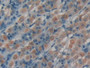 DAB staining on fromalin fixed paraffin- embedded stomach tissue)