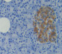 Target Of The Antiproliferative Antibody 1 (Tapa1) Polyclonal Antibody, Cat#CAU26438