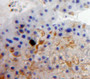 Used in DAB staining on fromalin fixed paraffin-embedded Liver tissue