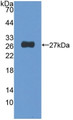 Western Blot; Sample: Recombinant NUP155, Human.