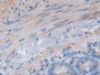 DAB staining on IHC-P; Samples: Rat Small intestine Tissue)