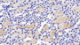 DAB staining on IHC-P; Samples: Mouse Kidney Tissue; Primary Ab: 20µg/ml Rabbit Anti-Mouse MAPK8 Antibody Second Ab: 2µg/mL HRP-Linked Caprine Anti-Rabbit IgG Polyclonal Antibody