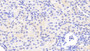 DAB staining on IHC-P. Samples: Human Tissue)