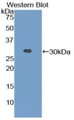 Western Blot; Sample: Recombinant protein.