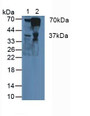 Western Blot; Sample: Lane1: Human Liver Tissue; Lane2: Human Blood Cells.