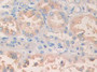 DAB staining on fromalin fixed paraffin- embedded lung tissue)