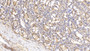 DAB staining on IHC-P; Samples: Human Small intestine Tissue; Primary Ab: 20µg/ml Rabbit Anti-Human PLA1 Antibody Second Ab: 2µg/mL HRP-Linked Caprine Anti-Rabbit IgG Polyclonal Antibody