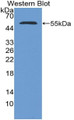 Western Blot; Sample: Recombinant protein.