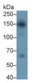 Western Blot; Sample: Human Serum; Primary Ab: 2μg/ml Rabbit Anti-Human NUP153 Antibody; Second Ab: 0.2µg/mL HRP-Linked Caprine Anti-Rabbit IgG Polyclonal Antibody;