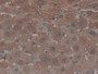 DAB staining on IHC-P; Samples: Human Liver Tissue; Primary Ab: 10µg/ml Rabbit Anti-Human NUP153 Antibody Second Ab: 2µg/mL HRP-Linked Caprine Anti-Rabbit IgG Polyclonal Antibody