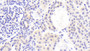 DAB staining on IHC-P; Samples: Human Kidney Tissue;  Primary Ab: 20μg/ml Rabbit Anti-Human CDHOB Antibody Second Ab: 2µg/mL HRP-Linked Caprine Anti-Rabbit IgG Polyclonal Antibody 