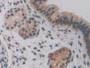 DAB staining on fromalin fixed paraffin- embedded kidney tissue)