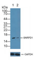 Knockout Varification: ; Lane 1: Wild-type Jurkat cell lysate; ; Lane 2: SNRPD1 knockout Jurkat cell lysate; ; Predicted MW: 13kd ; Observed MW: 16kd; Primary Ab: 1µg/ml Rabbit Anti-Human SNRPD1 Antibody; Second Ab: 0.2µg/mL HRP-Linked Caprine Anti-Rabbit IgG Polyclonal Antibody;