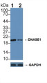 Knockout Varification: &lt;br/&gt;Lane 1: Wild-type 293T cell lysate; &lt;br/&gt;Lane 2: DNASE1 knockout 293T cell lysate; &lt;br/&gt;Predicted MW: 20,31kDa &lt;br/&gt;Observed MW: 20kDa&lt;br/&gt;Primary Ab: 2µg/ml Rabbit Anti-Human DNASE1 Antibody&lt;br/&gt;Second Ab: 0.2µg/mL HRP-Linked Caprine Anti-Rabbit IgG Polyclonal Antibody&lt;br/&gt;