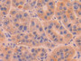 DAB staining on IHC-P; Samples: Human Liver Tissue