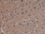 DAB staining on IHC-P; Samples: Human Liver Tissue;  Primary Ab: 20µg/ml Rabbit Anti-Human ARG Antib
