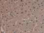 DAB staining on IHC-P; Samples: Human Liver Tissue