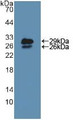 Western Blot; Sample: Recombinant NUP85, Mouse.