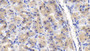 DAB staining on IHC-P; Samples: Human Stomach Tissue; Primary Ab: 20μg/ml Rabbit Anti-Human NUP85 Antibody Second Ab: 2µg/mL HRP-Linked Caprine Anti-Rabbit IgG Polyclonal Antibody