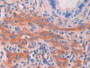 DAB staining on IHC-P; Samples: Mouse Uterus Tissue