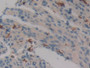 DAB staining on fromalin fixed paraffin- embedded intestine tissue)