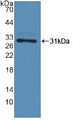 Western Blot; Sample: Recombinant F13A1, Human.