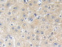 DAB staining on IHC-P; Samples: Human Liver Tissue; Primary Ab: 10µg/ml Rabbit Anti-Human BFP Antibody Second Ab: 2µg/mL HRP-Linked Caprine Anti-Rabbit IgG Polyclonal Antibody