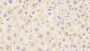 DAB staining on fromalin fixed paraffin-embedded Liver tissue)