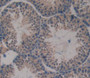 Used in DAB staining on fromalin fixed paraffin- embedded Kidney tissue