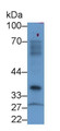 Nucleoporin 37 (NUP37) Polyclonal Antibody, CAU26529