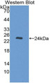 Western Blot; Sample: Recombinant protein.