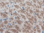 DAB staining on IHC-P; Samples: Mouse Cerebrum Tissue;  Primary Ab: 20µg/ml Rabbit Anti-Mouse EGR4 A