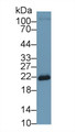 Western Blot; Sample: Human MCF7 cell lysate; Primary Ab: 1µg/ml Rabbit Anti-Rat SOD2 Antibody Second Ab: 0.2µg/mL HRP-Linked Caprine Anti-Rabbit IgG Polyclonal Antibody 