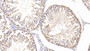 DAB staining on IHC-P; Samples: Rat Testis Tissue; Primary Ab: 20μg/ml Rabbit Anti-Rat SOD2 Antibody Second Ab: 2µg/mL HRP-Linked Caprine Anti-Rabbit IgG Polyclonal Antibody