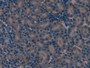 DAB staining on IHC-P; Samples: Mouse Kidney Tissue; Primary Ab: 10µg/ml Rabbit Anti-Mouse SOD2 Antibody Second Ab: 2µg/mL HRP-Linked Caprine Anti-Rabbit IgG Polyclonal Antibody
