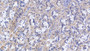 DAB staining on IHC-P; Samples: Human Stomach Tissue; Primary Ab: 20µg/ml Rabbit Anti-Human HSPA9 Antibody Second Ab: 2µg/mL HRP-Linked Caprine Anti-Rabbit IgG Polyclonal Antibody