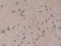 DAB staining on IHC-P; Samples: Human Brain Tissue; Primary Ab: 10µg/ml Rabbit Anti-Human HSPA1A Antibody Second Ab: 2µg/mL HRP-Linked Caprine Anti-Rabbit IgG Polyclonal Antibody