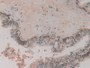 DAB staining on IHC-P; Samples：Human Prostate Tissue.