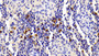 DAB staining on IHC-P; Samples: Porcine Spleen Tissue; Primary Ab: 10μg/ml Rabbit Anti-Porcine S100A12 Antibody Second Ab: 2µg/mL HRP-Linked Caprine Anti-Rabbit IgG Polyclonal Antibody
