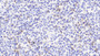 DAB staining on IHC-P; Samples: Human Spleen Tissue; Primary Ab: 20μg/ml Rabbit Anti-Human S100A12 Antibody Second Ab: 2µg/mL HRP-Linked Caprine Anti-Rabbit IgG Polyclonal Antibody