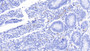 DAB staining on IHC-P; Samples: Bovine Small intestine Tissue; Primary Ab: 20μg/ml Rabbit Anti-Bovine S100A12 Antibody Second Ab: 2µg/mL HRP-Linked Caprine Anti-Rabbit IgG Polyclonal Antibody