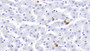 DAB staining on IHC-P; Samples: Bovine Liver Tissue; Primary Ab: 20μg/ml Rabbit Anti-Bovine S100A12 Antibody Second Ab: 2µg/mL HRP-Linked Caprine Anti-Rabbit IgG Polyclonal Antibody