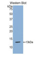 Western Blot; Sample: Recombinant protein.