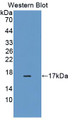 Western Blot; Sample: Recombinant protein.