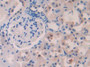 DAB staining on fromalin fixed paraffin- embedded stomach tissue)