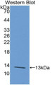 Western Blot; Sample: Recombinant protein.