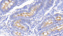 DAB staining on IHC-P; Samples: Bovine Small intestine Tissue; Primary Ab: 20μg/ml Rabbit Anti-Bovine PIGR Antibody Second Ab: 2µg/mL HRP-Linked Caprine Anti-Rabbit IgG Polyclonal Antibody