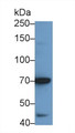 Western Blot; Sample: Recombinant protein.