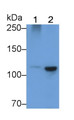 Western Blot; Sample: Lane1: Mouse Cerebrum lysate; Lane2: A375 cell lysate; Primary Ab: 3μg/ml Rabbit Anti-Human HSPA4 Antibody; Second Ab: 0.2µg/mL HRP-Linked Caprine Anti-Rabbit IgG Polyclonal Antibody;